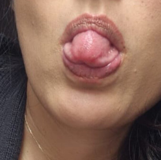@roaaarrr